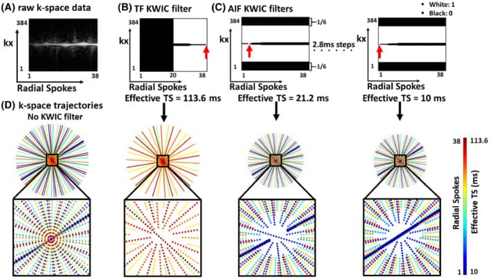 Quantitative cardiac perfusion MRI figure relevant to Lexiaozi Fan's cardiovascular MRI work