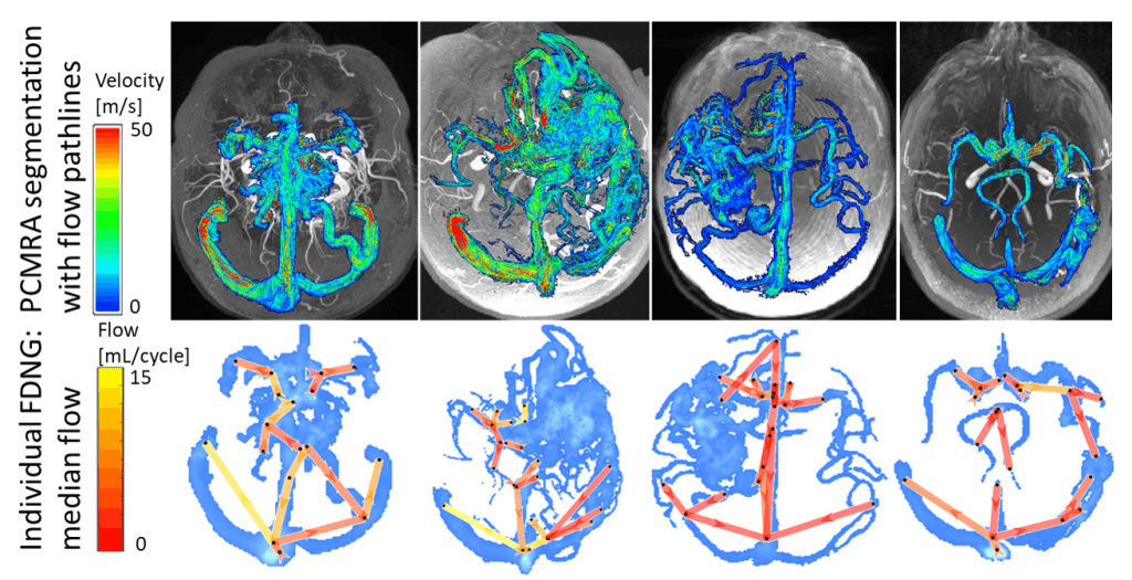 Cerebrovascular 4D flow figure showing complex cranial blood-flow visualization.